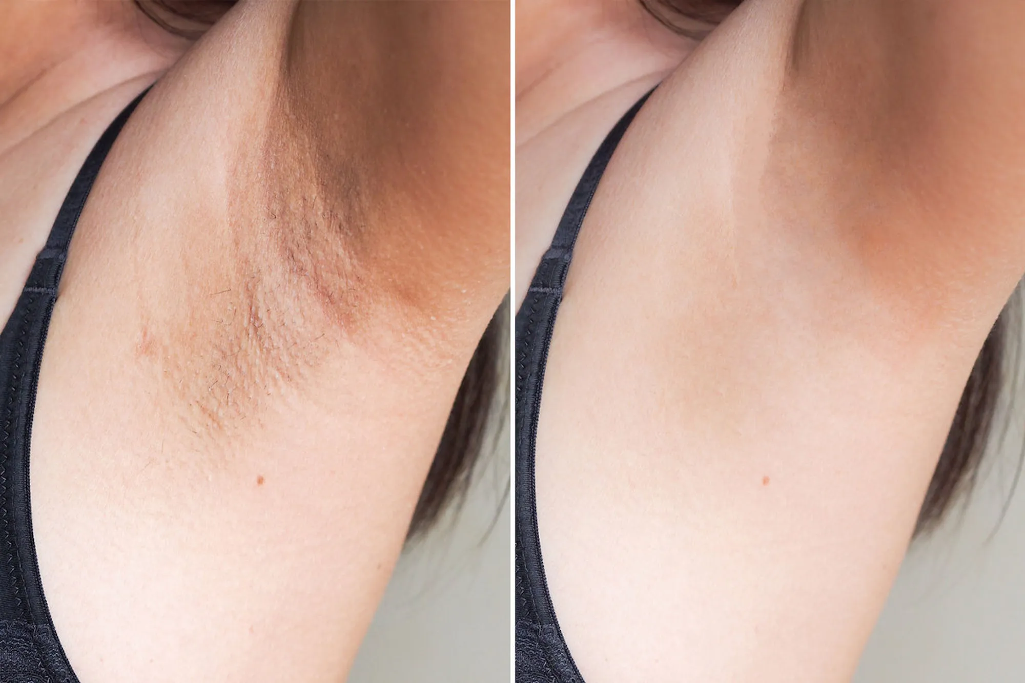 Body-Dark-Patches-Corrector-Will-Make-You-Want-to-Show-Off-All-Your-Skin-001