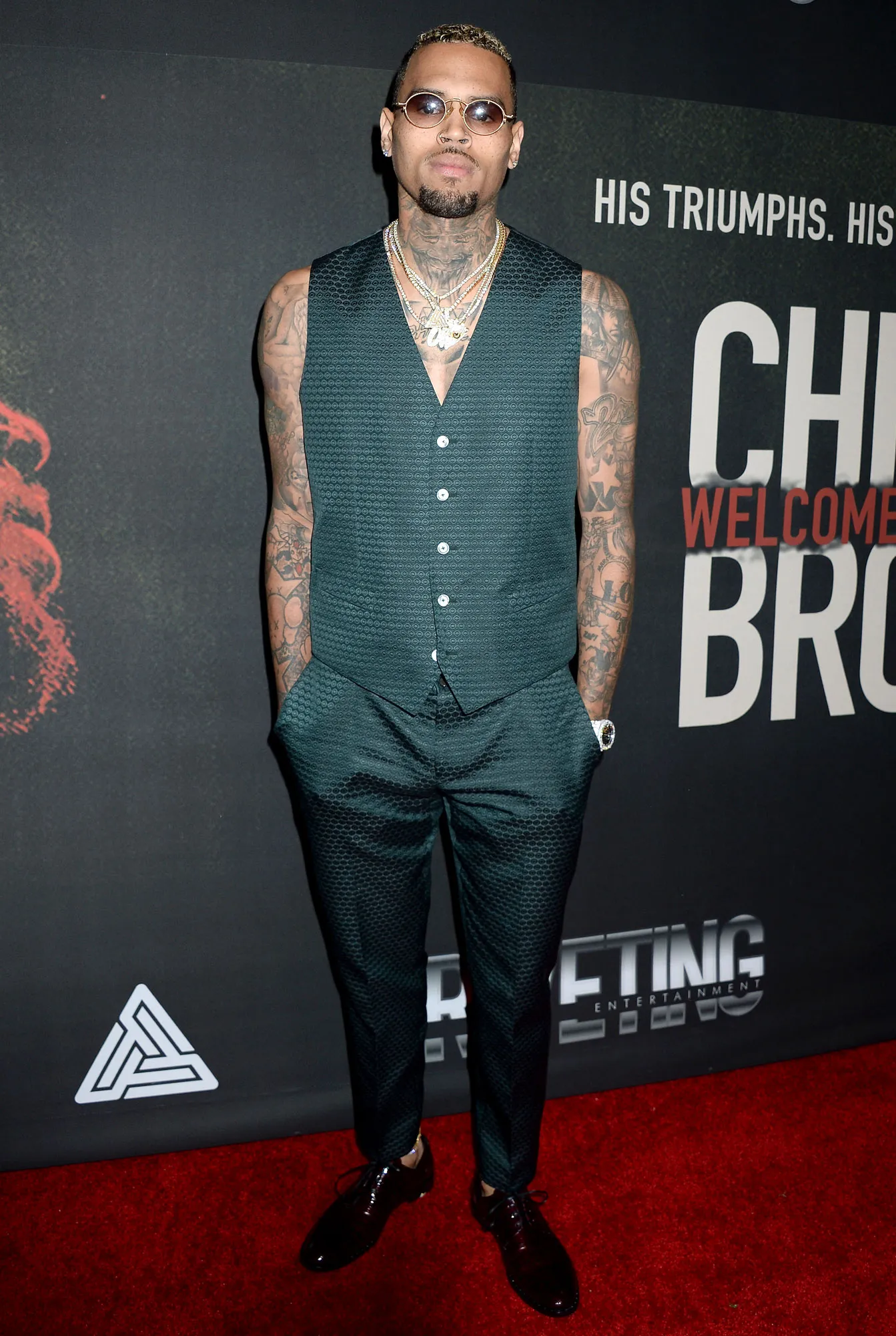 Chris Brown 24-Carat Gold Grill Magnetically Attaches to His Teeth