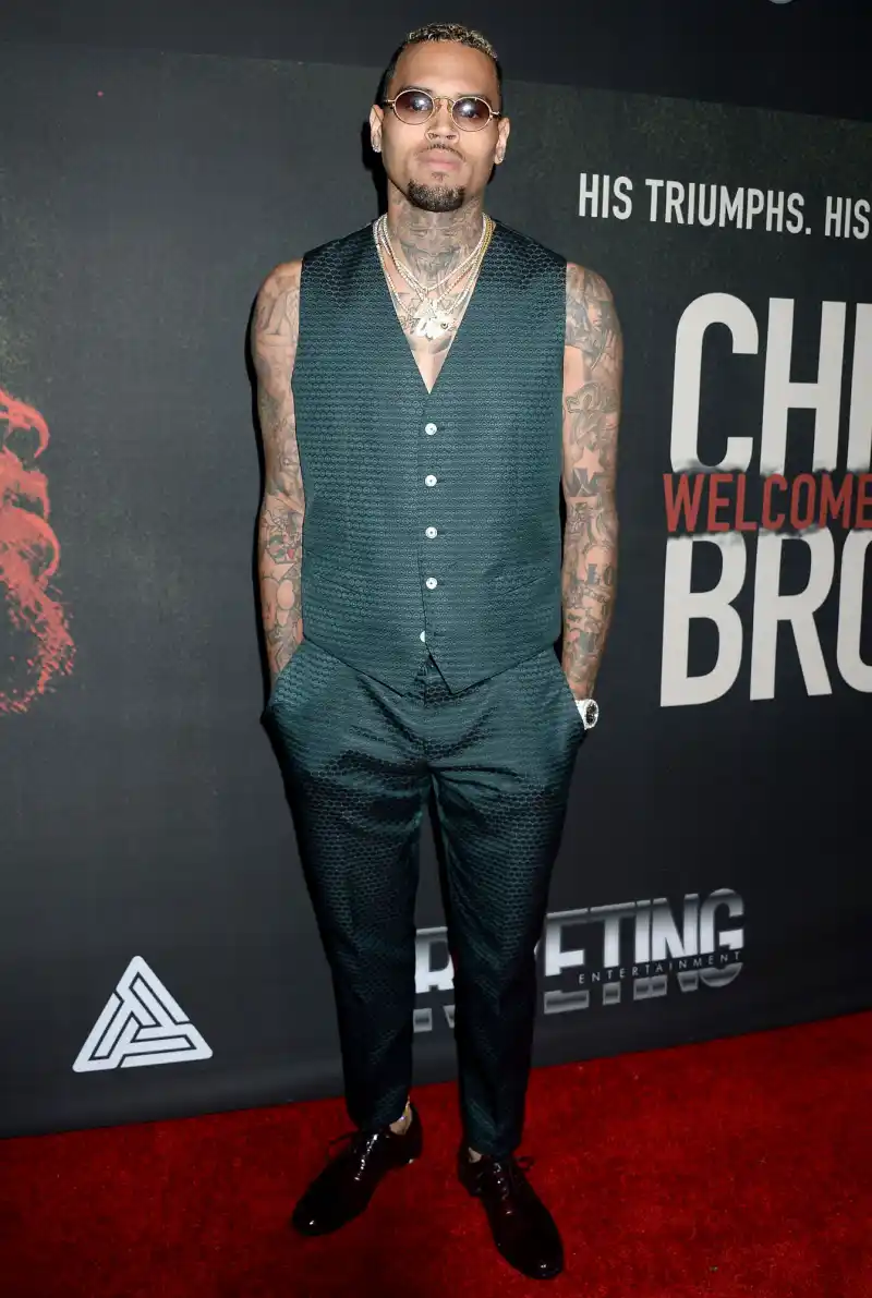 Chris Brown 24-Carat Gold Grill Magnetically Attaches to His Teeth