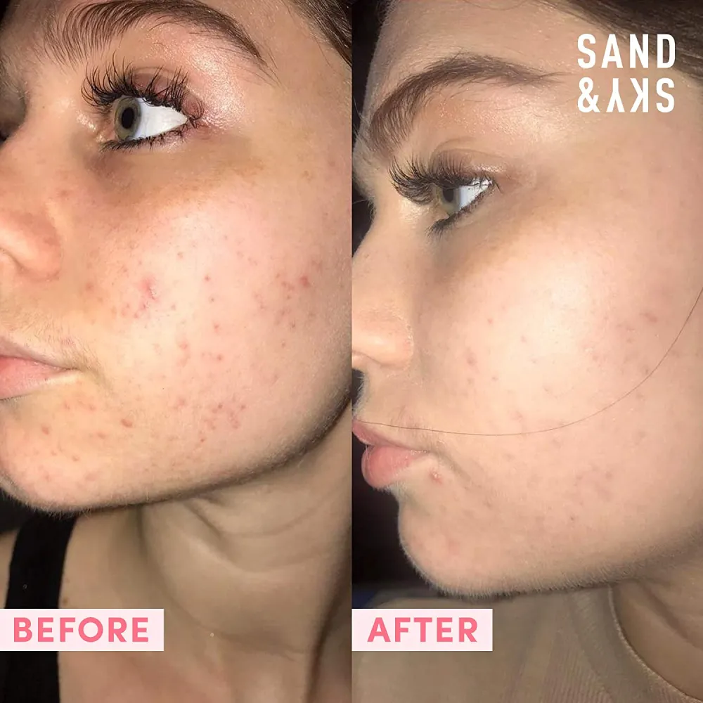 Sand & Sky Australian Pink Clay Porefining Face Mask