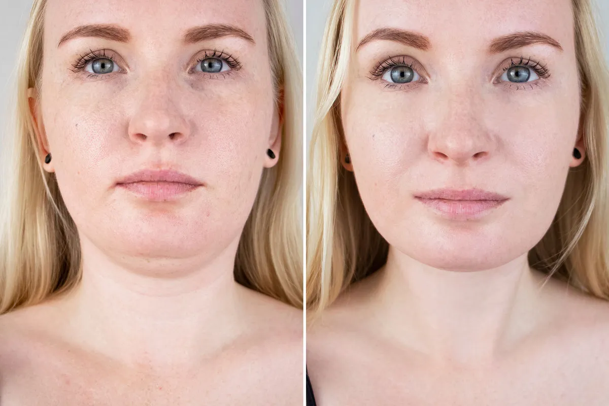 This-Retinol-Collagen-Lifting-Cream-Shows-Serious-Results-Just-15-Days