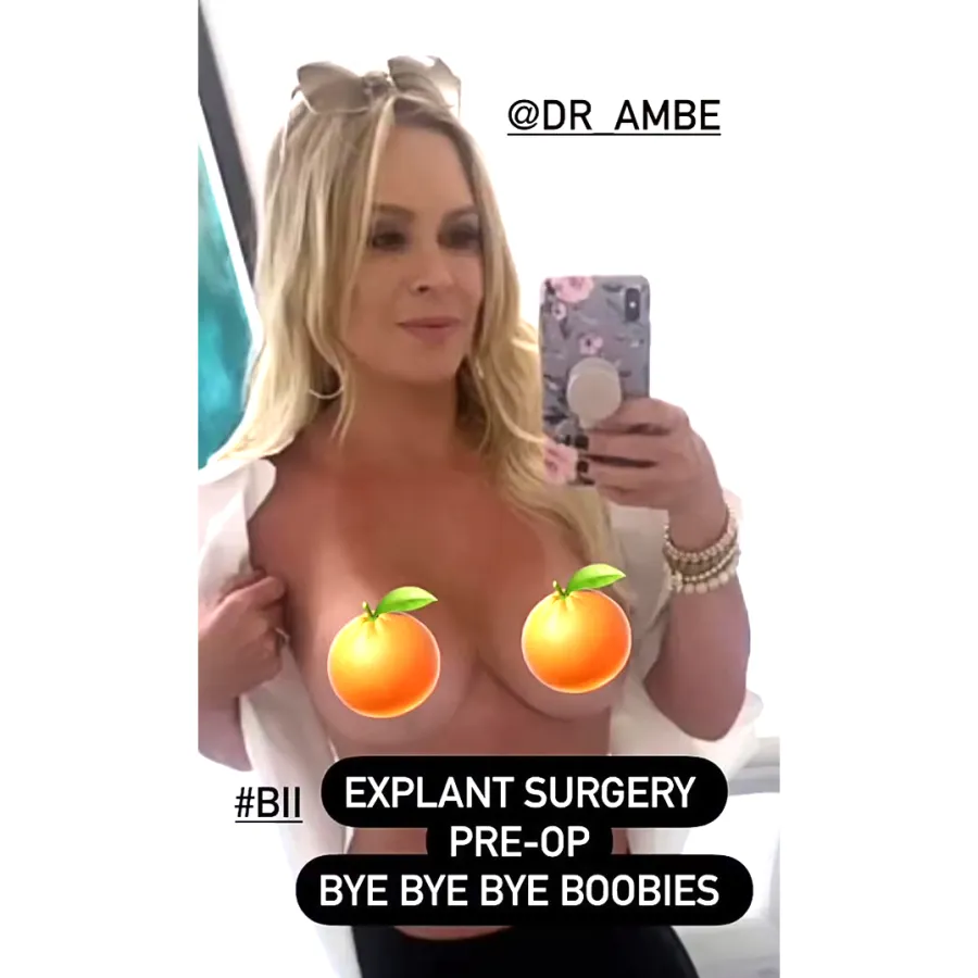 Celebs Who’ve Had Breast Implants Removed