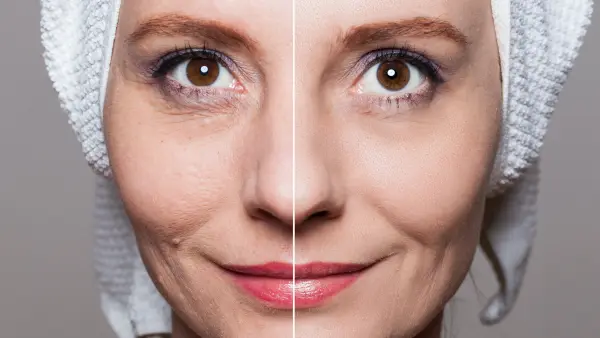 Before-After-Pore-Primer