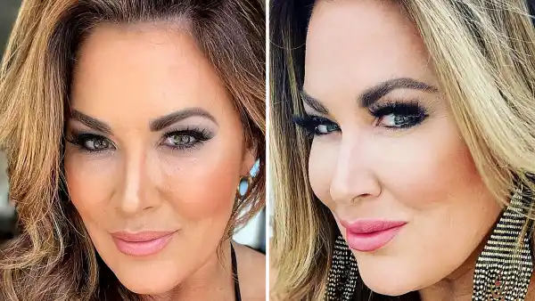 Emily Simpson Dissolves Filler: I Was Looking Like ‘The Cabbage Patch Kid’
