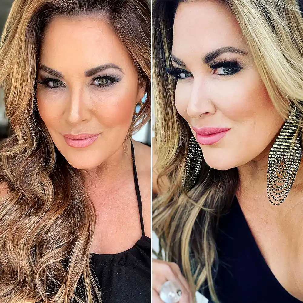 Emily Simpson Dissolves Filler: I Was Looking Like &lsquo;The Cabbage Patch Kid&rsquo;