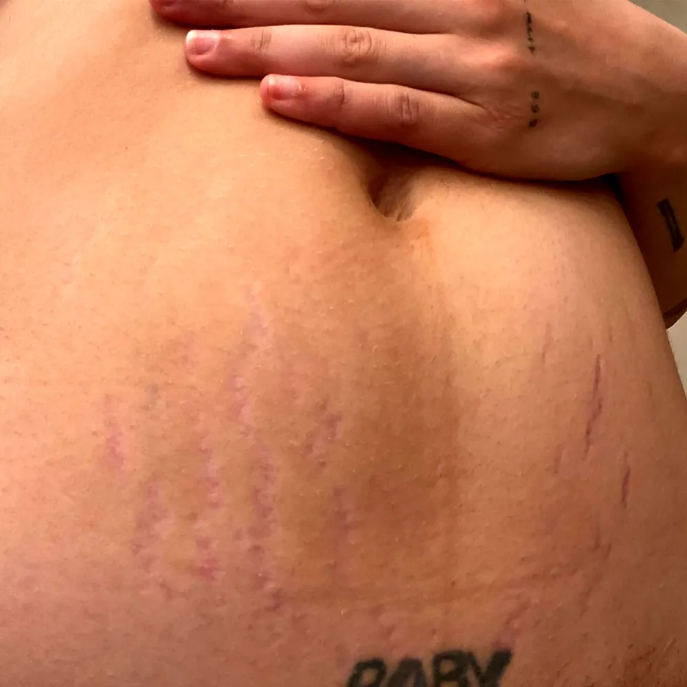 Halsey Shares Candid Snap of Postpartum Body: &lsquo;This Is What It Look Like&rsquo;