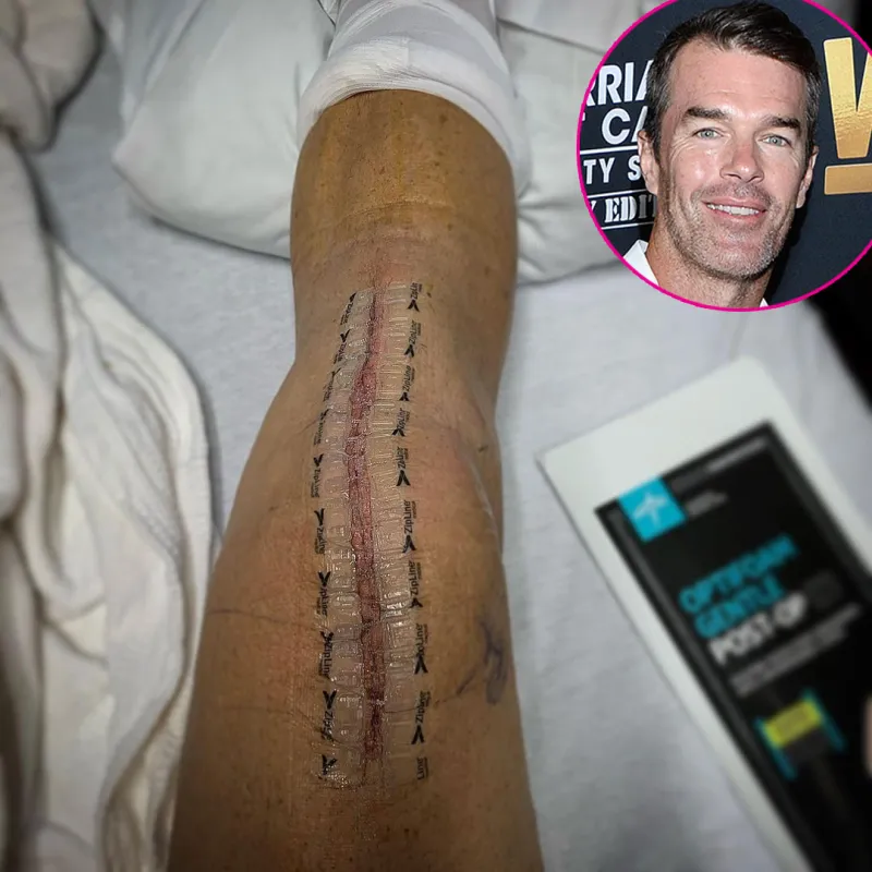 Ryan Sutter Reveals He Had Knee Replacement Surgery Amid Lyme Disease Battle