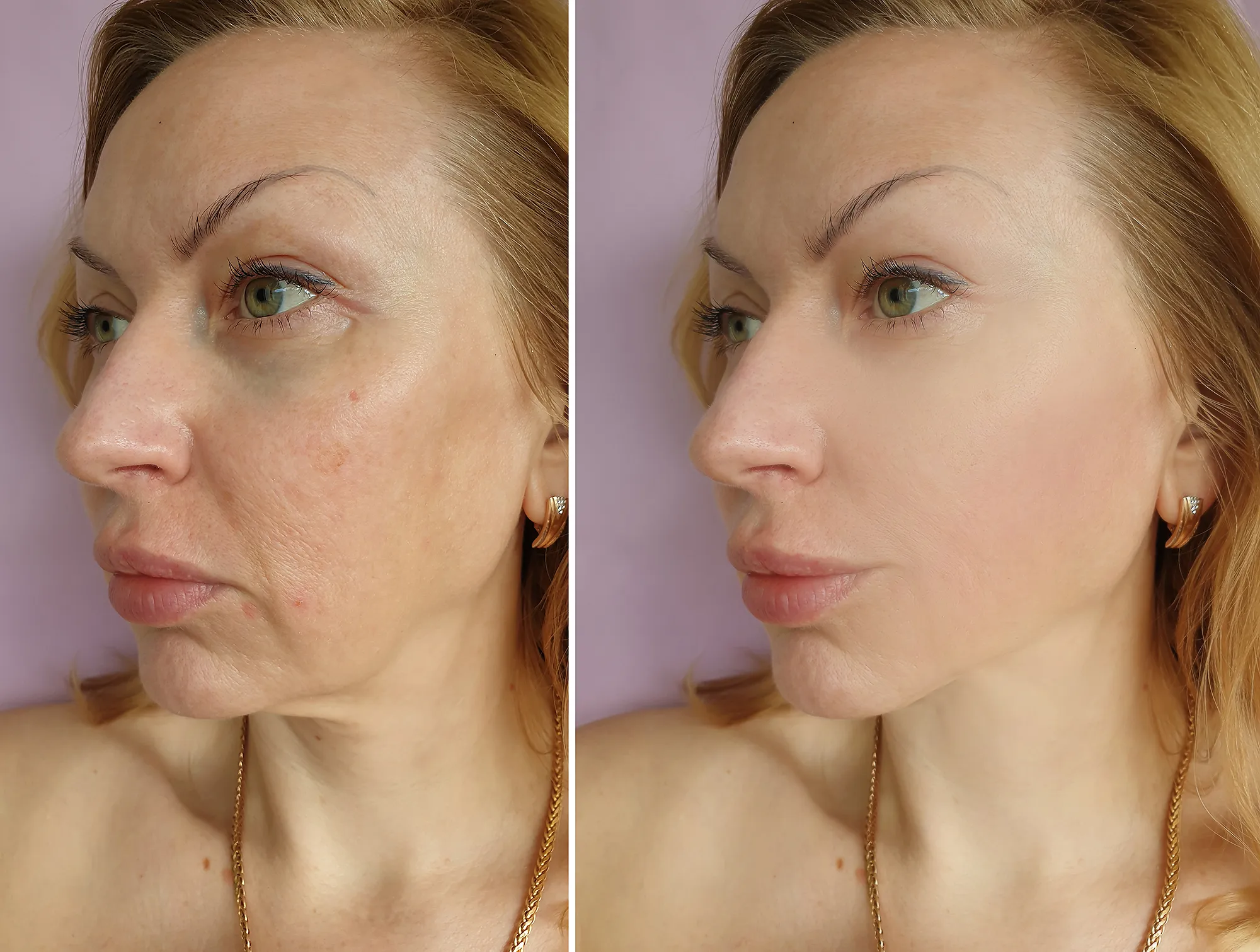 collagen-cream-sagging-skin