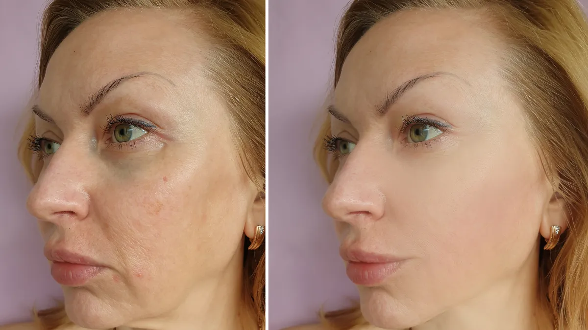 collagen-cream-sagging-skin