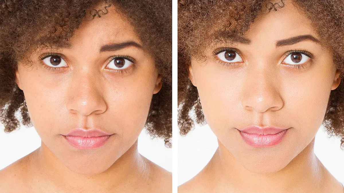 tired-skin-woman-before-after