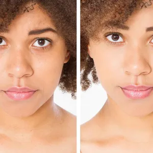 tired-skin-woman-before-after