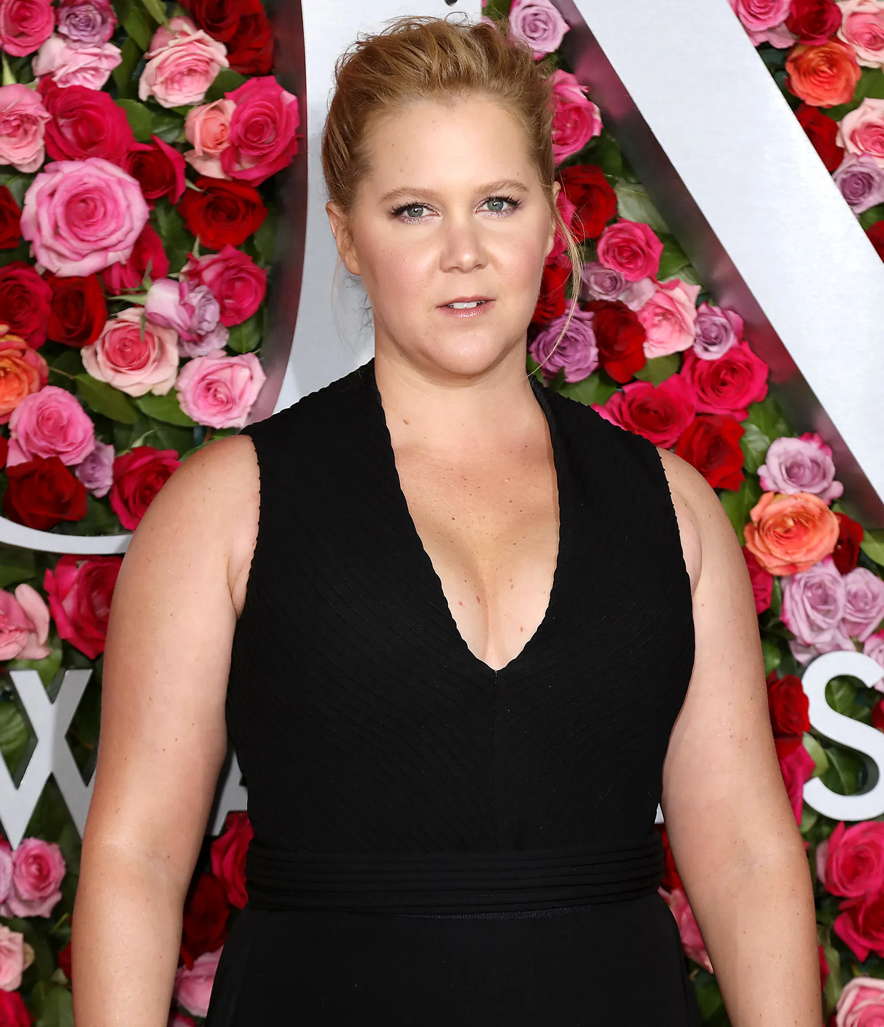 Amy Schumer Details Her Intense Endometriosis Surgery: ‘The Doctor Found 30 Spots’