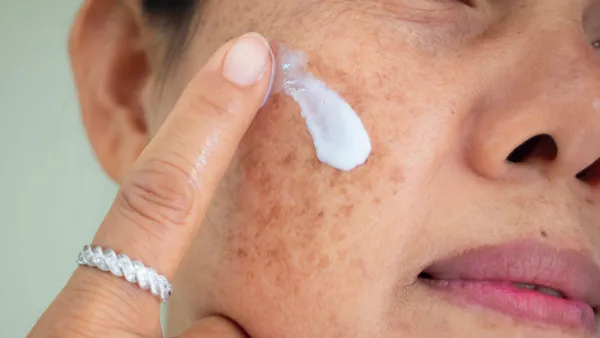 Dark-Spot-Stock-Photo