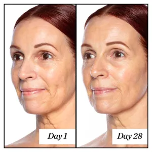 Good Genes All-in-One Lactic Acid Exfoliating Face Treatment