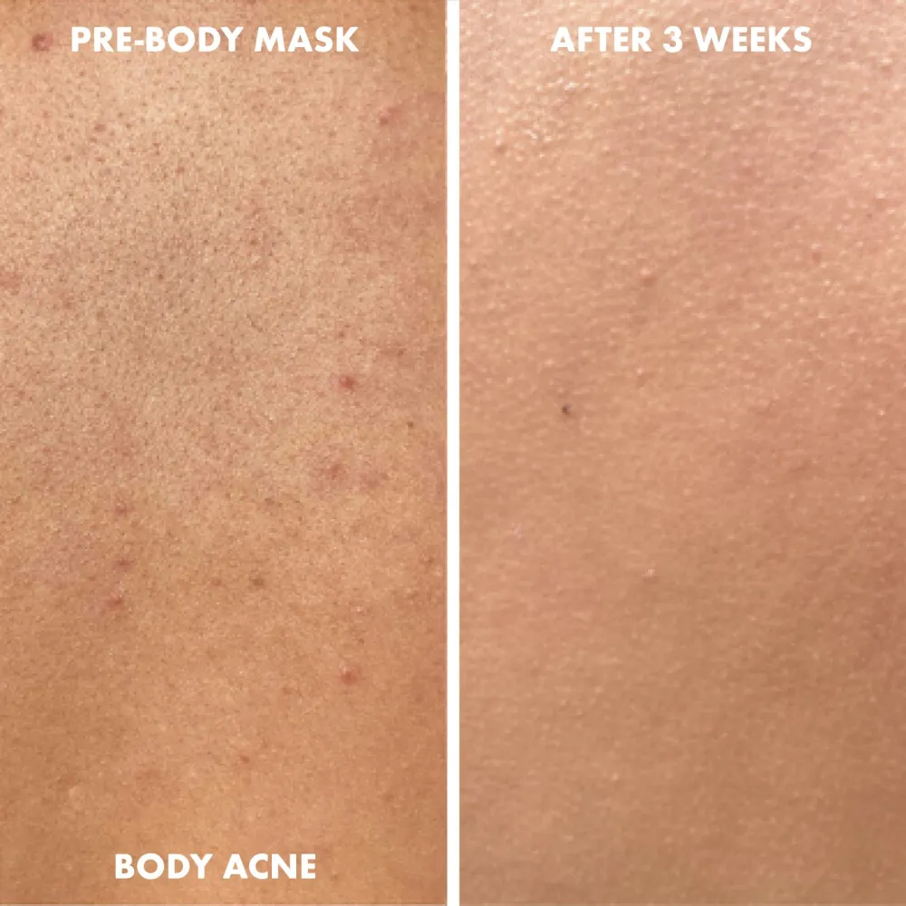 Pink Souffl&eacute; Body Mask With Niacinamide, Kaolin Clay, Dragon Fruit & Coconut Oil