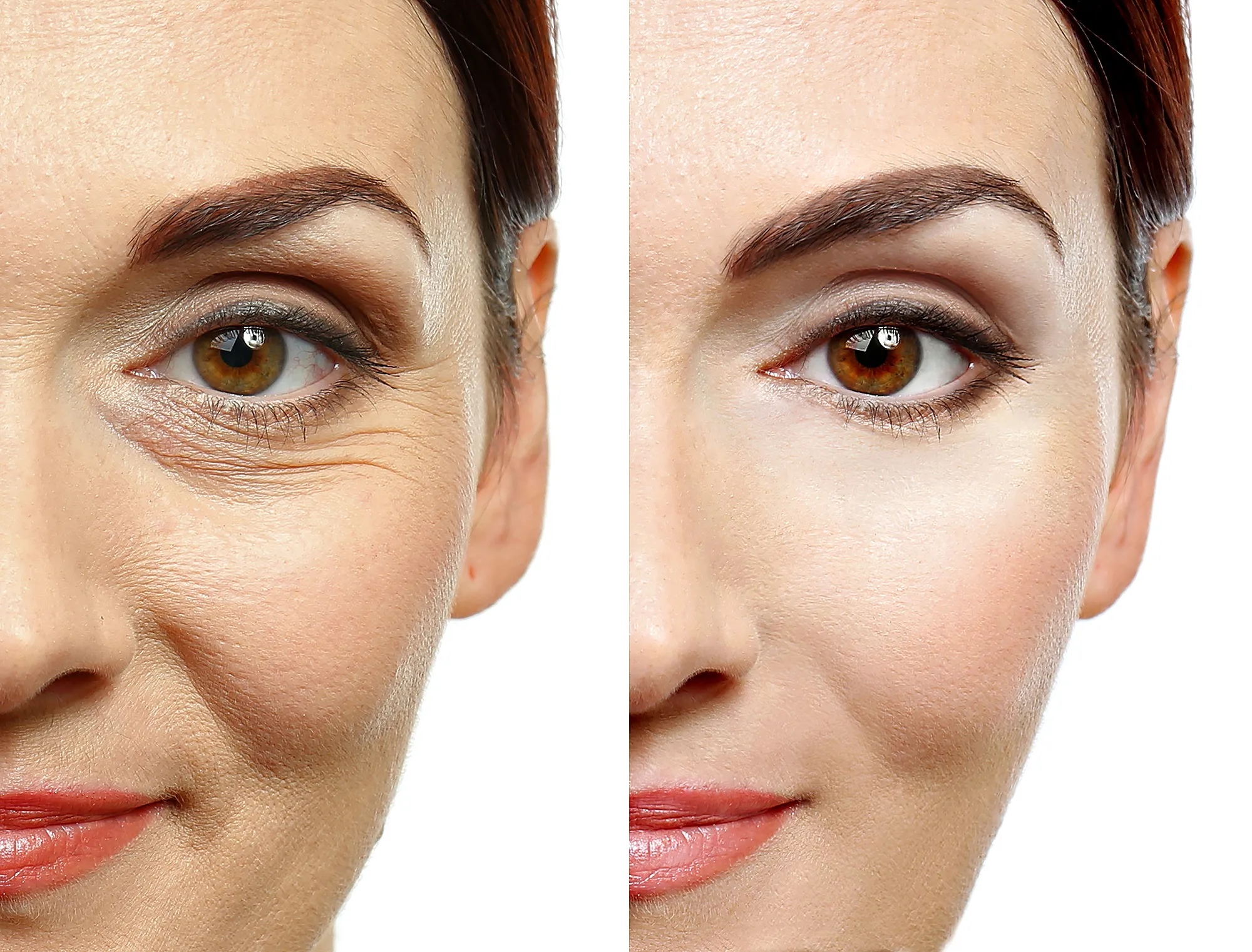caffeinated-eye-cream-wrinkle-before-after