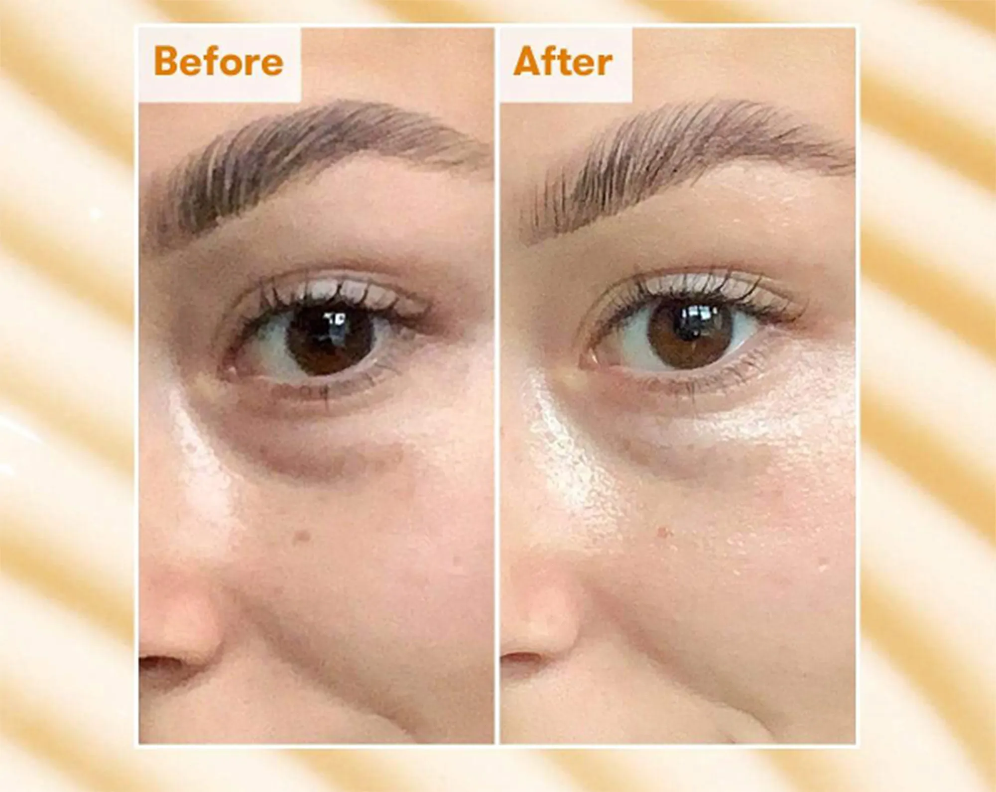 ren-eye-cream-before-after