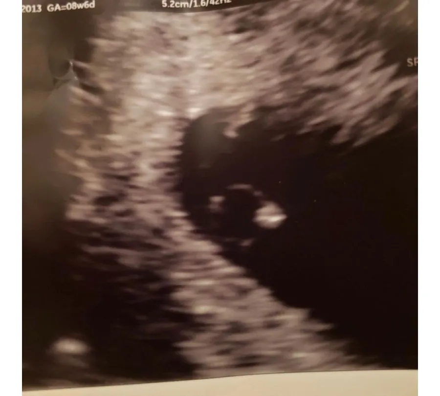 90 Day Fiance Colt Johnson and Vanessa Guerra Suffer Miscarriage 3