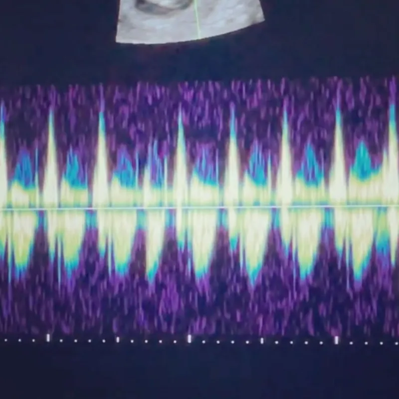 Darren Criss and Wife Mia Swier Are Expecting Their 1st Child: 'The Ultimate Collab Dropping