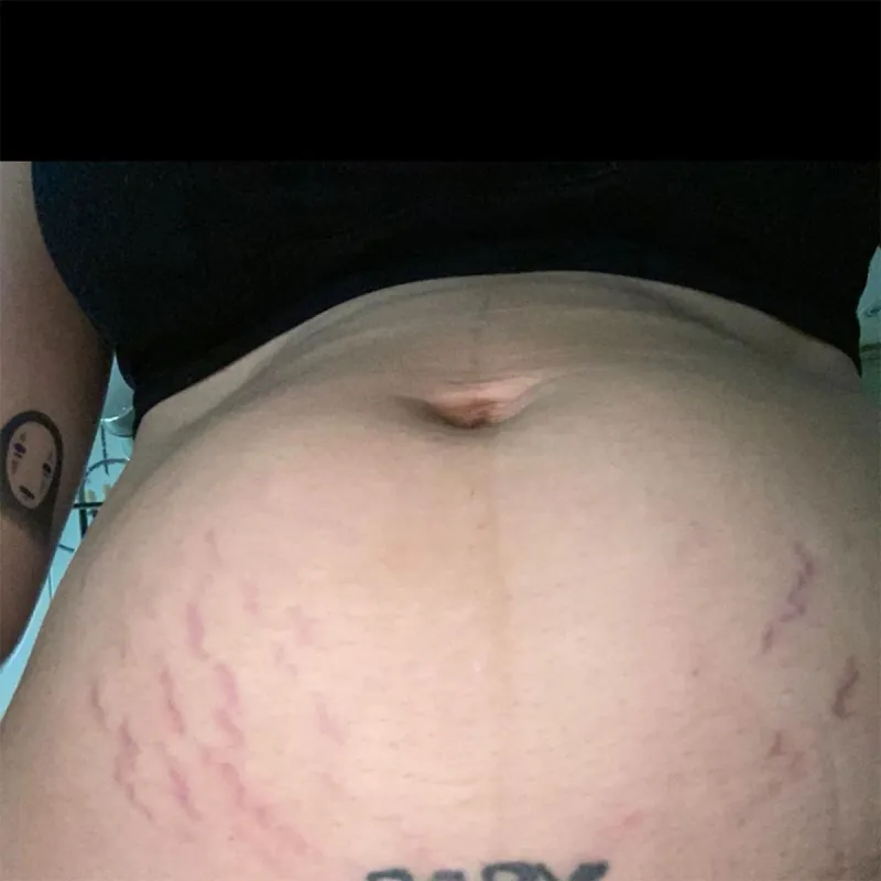 Halsey Shows Postpartum Body After ‘Saturday Night Live’ Performance: I’m Not ‘Superhuman'