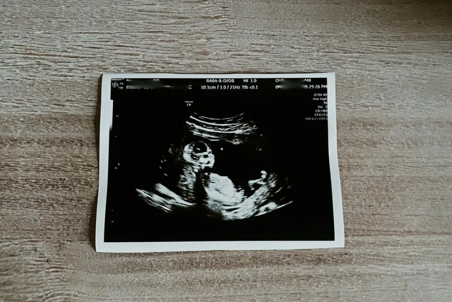 He’s All That’s Peyton Meyer Marries Girlfriend Taela, Reveals She’s Pregnant