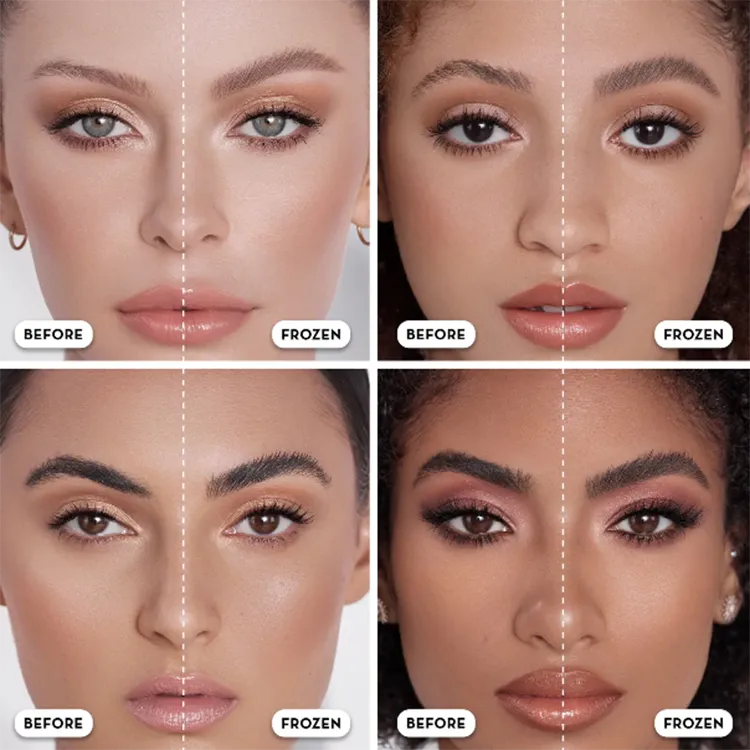 brow-freeze-before-after