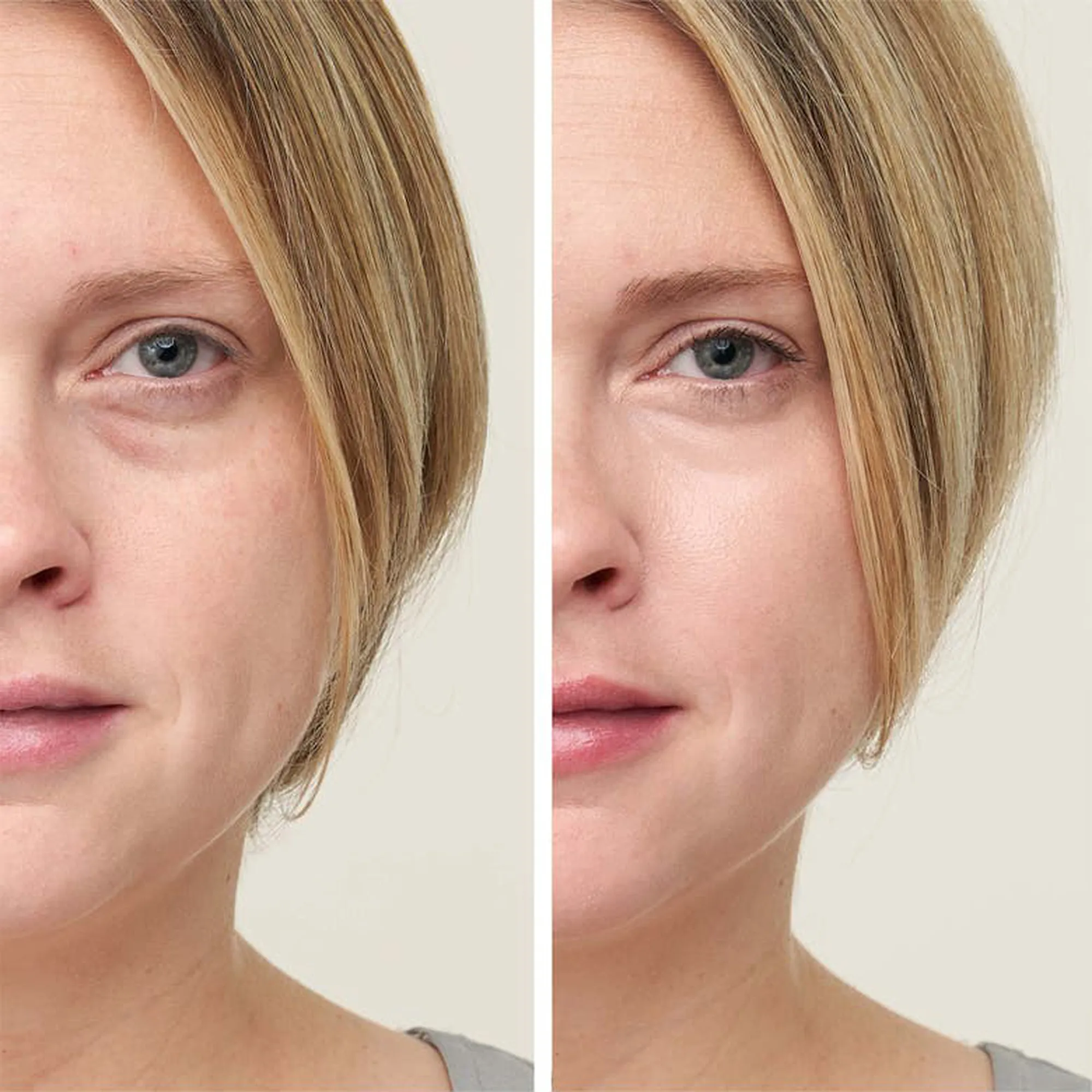 jane-iredale-concealer-before-after