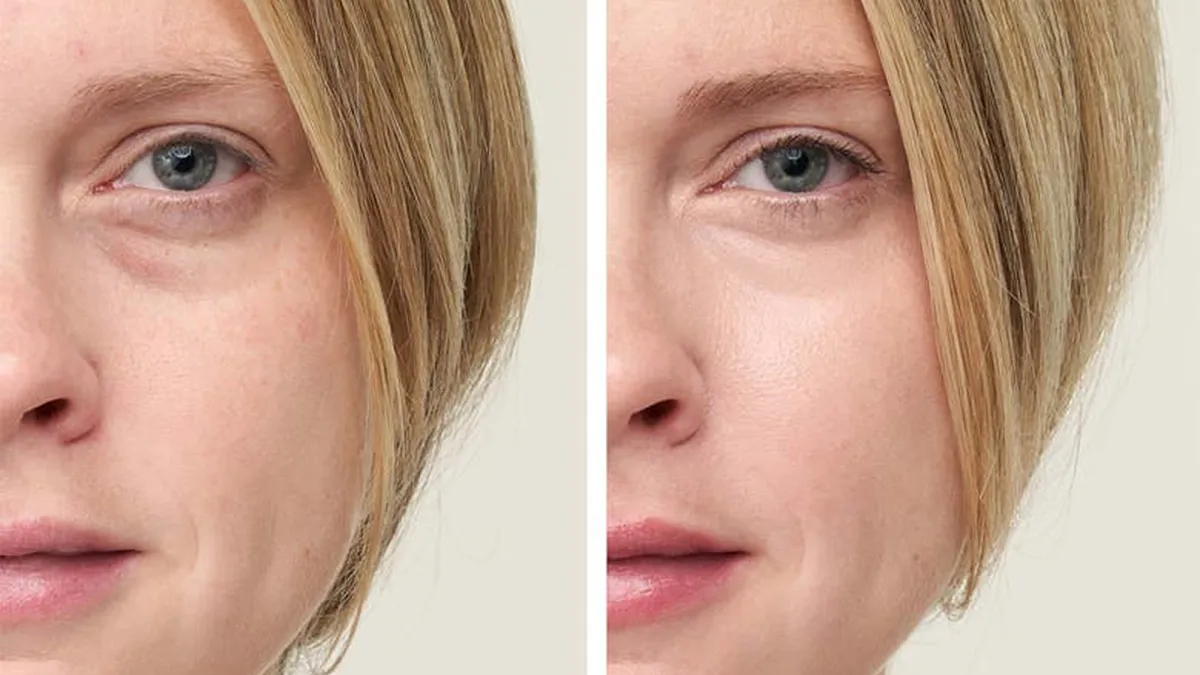 jane-iredale-concealer-before-after