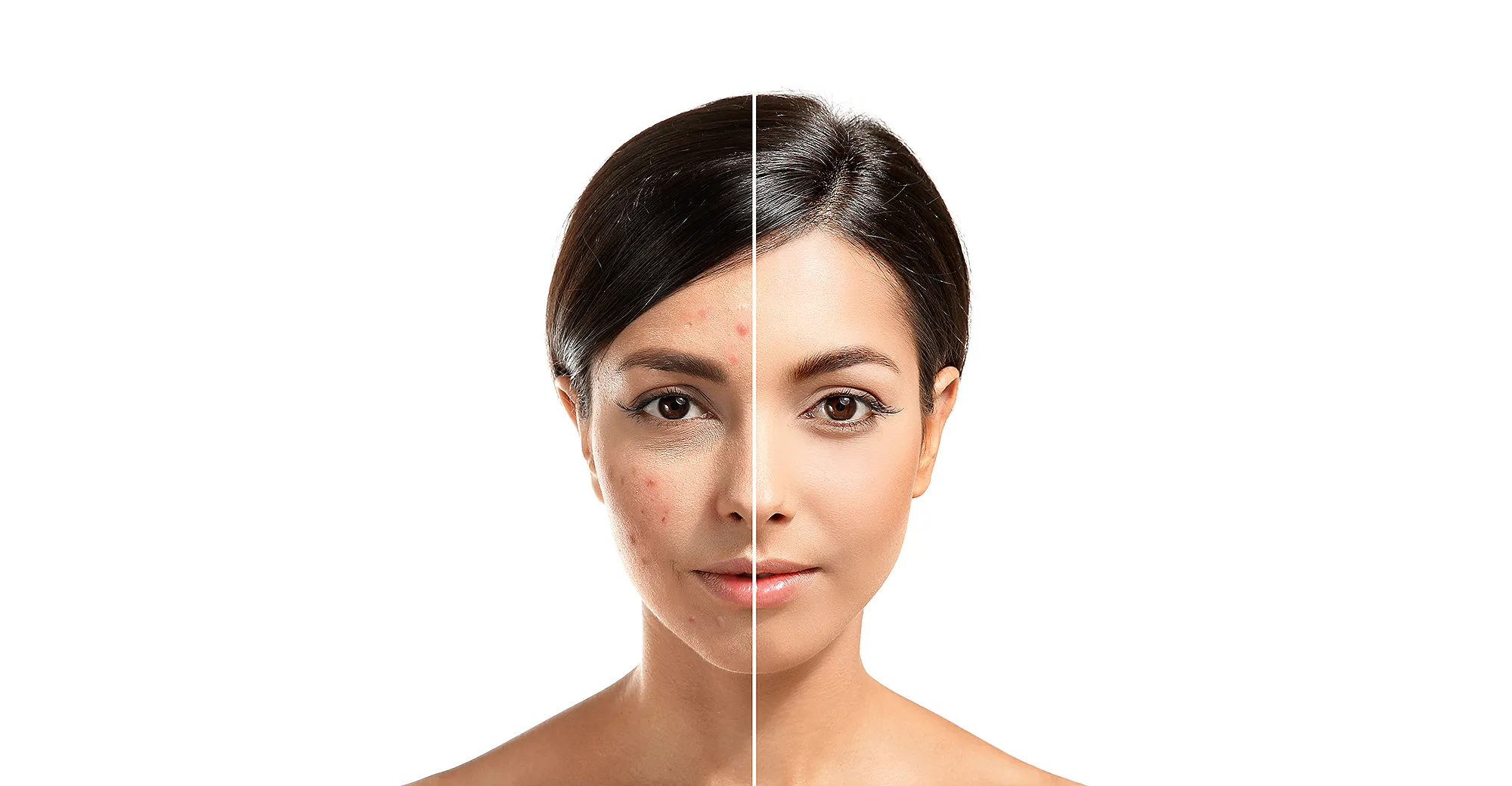 snail-cream-scream-before-after