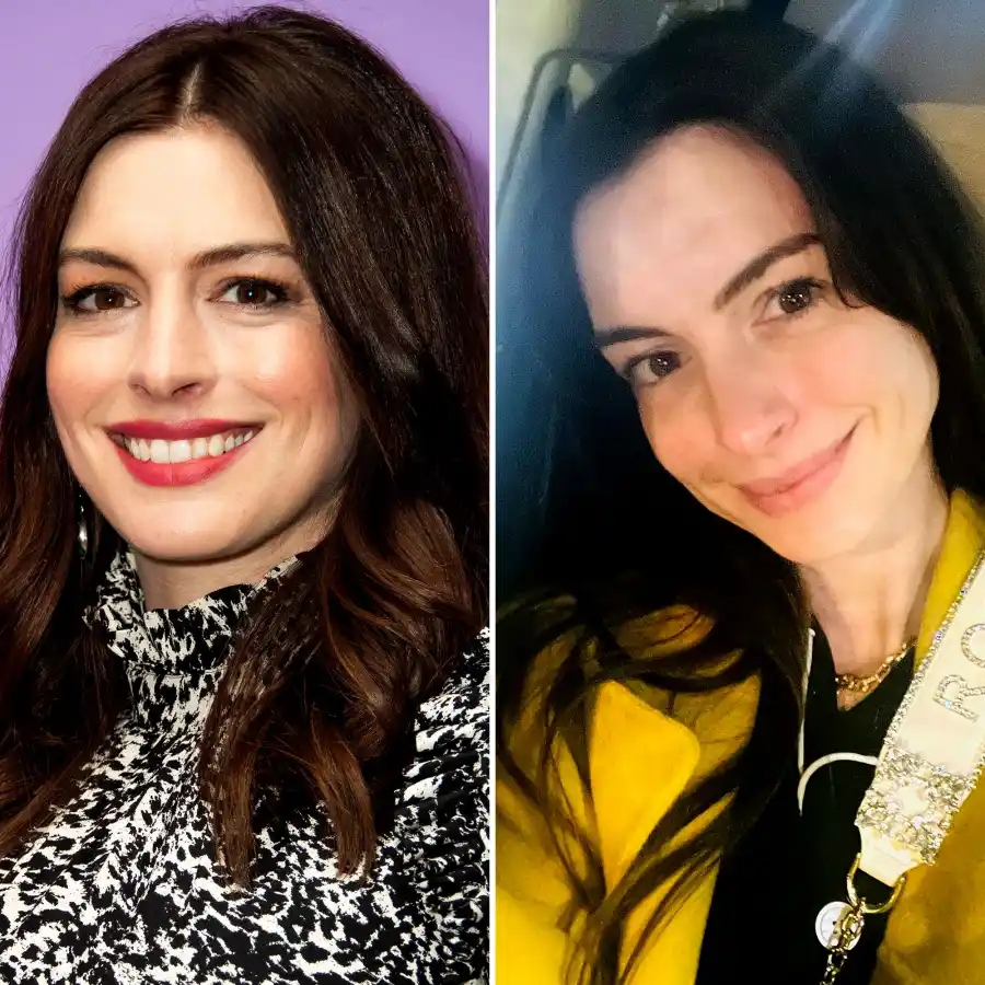 Anne Hathaway’s Makeup-Free Complexion Is Absolutely Flawless: Pic