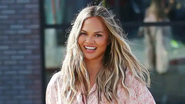 Chrissy Teigen Asks Why Eyebrow Transplant Has People Riled Up