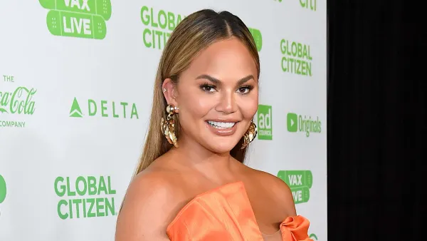 Chrissy Teigen Reveals She Had Eyebrow Transplant Surgery