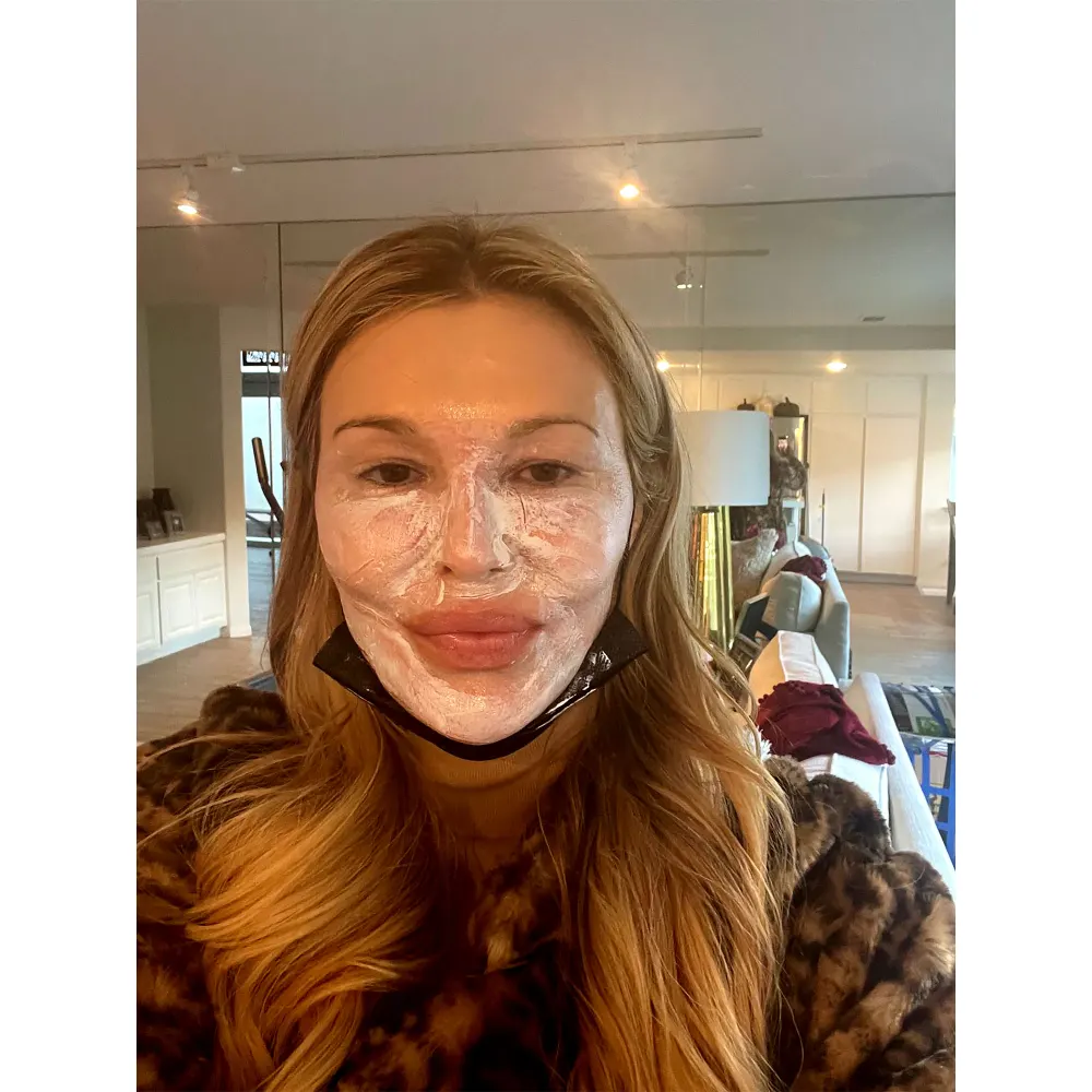 Everything to Know About Brandi Glanville&rsquo;s &lsquo;Snow Peel&rsquo; Treatment