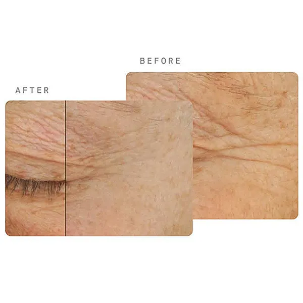 OS-01 Topical Supplement