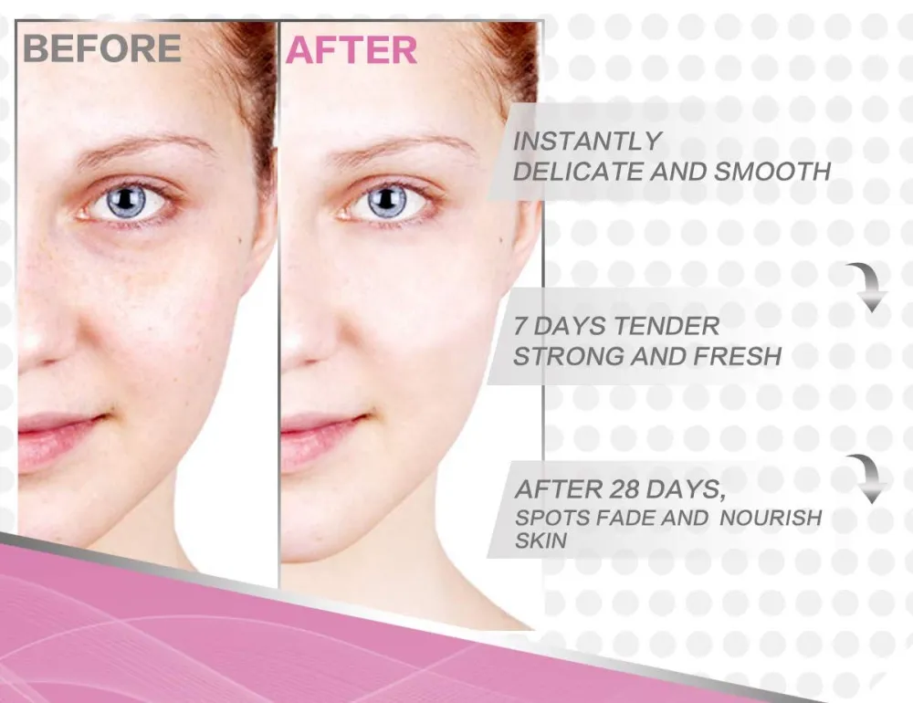 PDOO Dark Spot Corrector for Face and Body