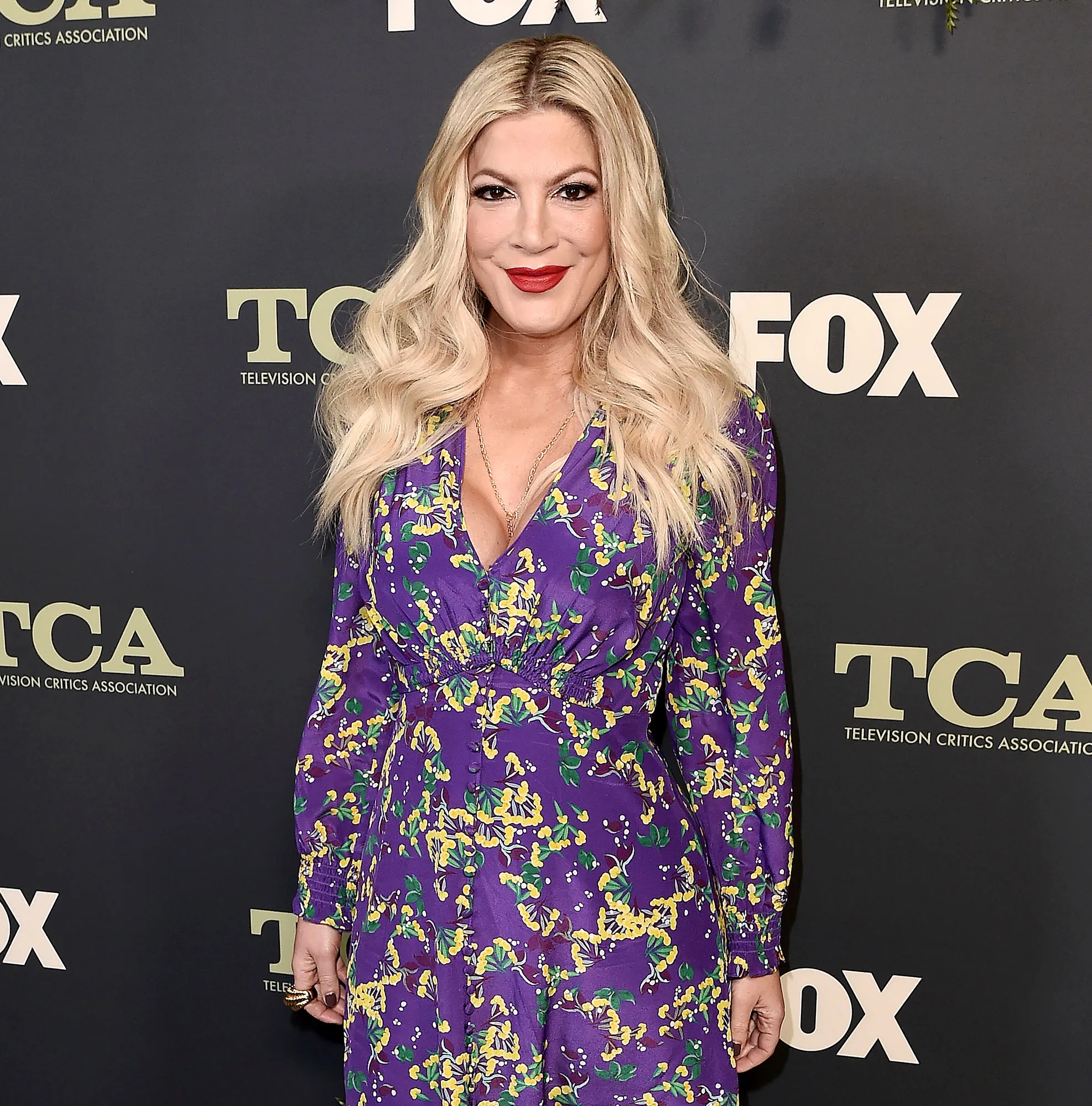 Tori Spelling Is Finally Addressing Her Expired Breast Implants Amid Dean McDermott Split Rumors 2