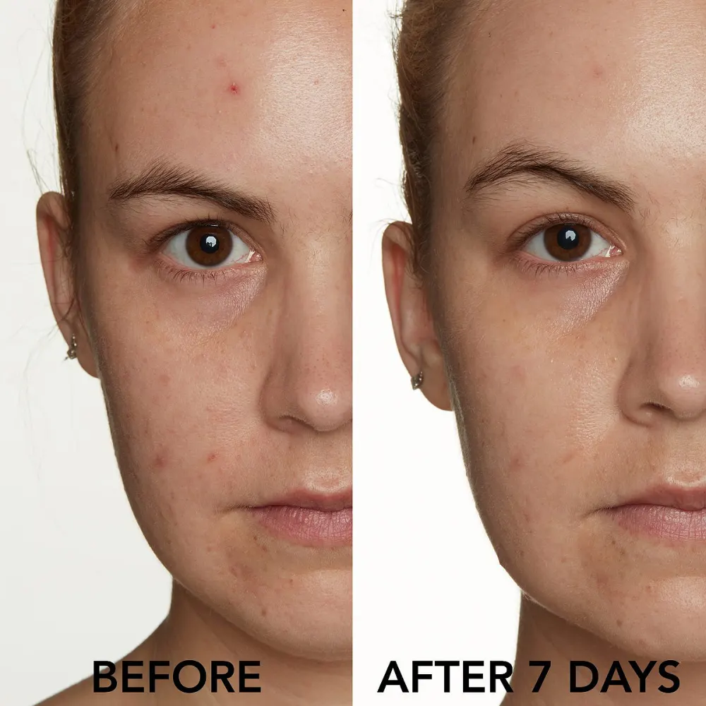 lancer-skincare-spot-treatment