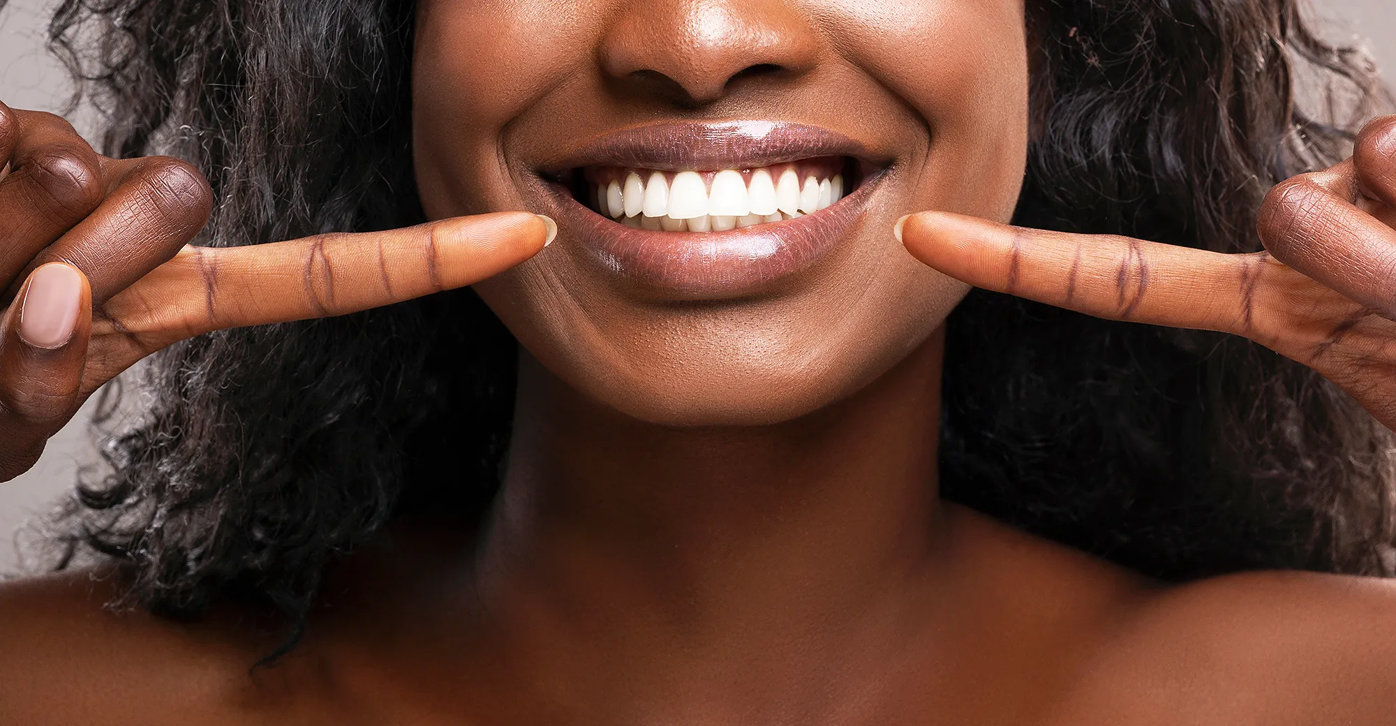 white-teeth-smile-whitening