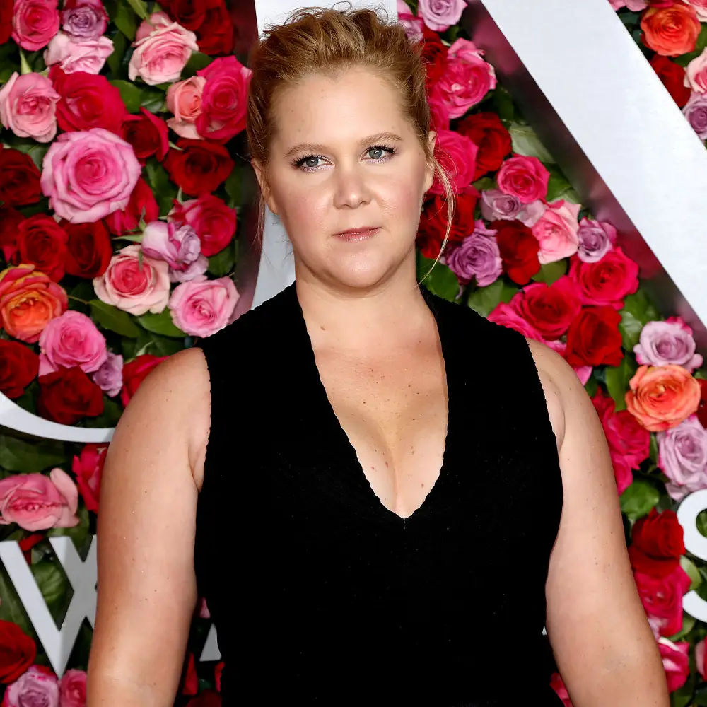 Amy Schumer Dissolves Her Facial Filler: &lsquo;I Looked Like Maleficent&rsquo;