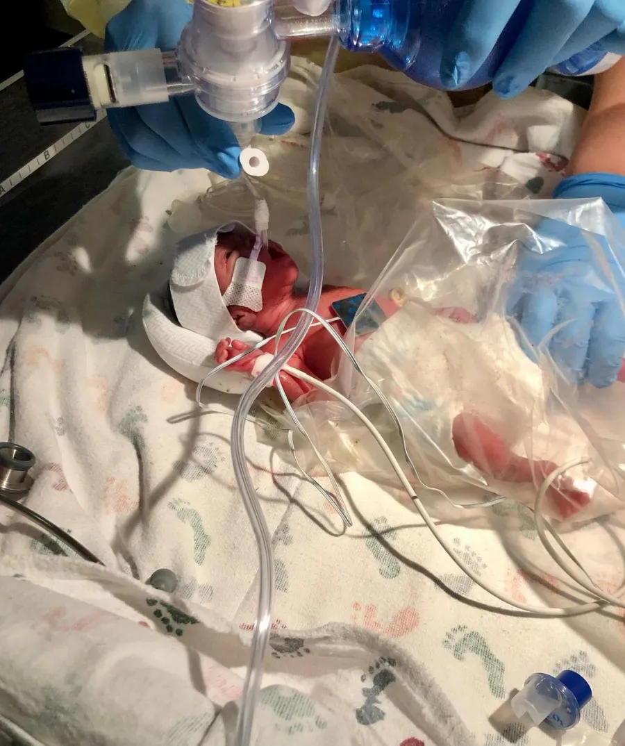 Floribama Shore’s Candace Welcomes Son at 24 Weeks: ‘Asking for Prayers’