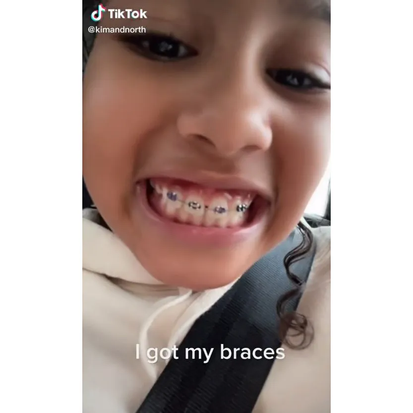 Kim Kardashian&rsquo;s Daughter North West, 8, Debuts Her Braces in Adorable TikTok Video