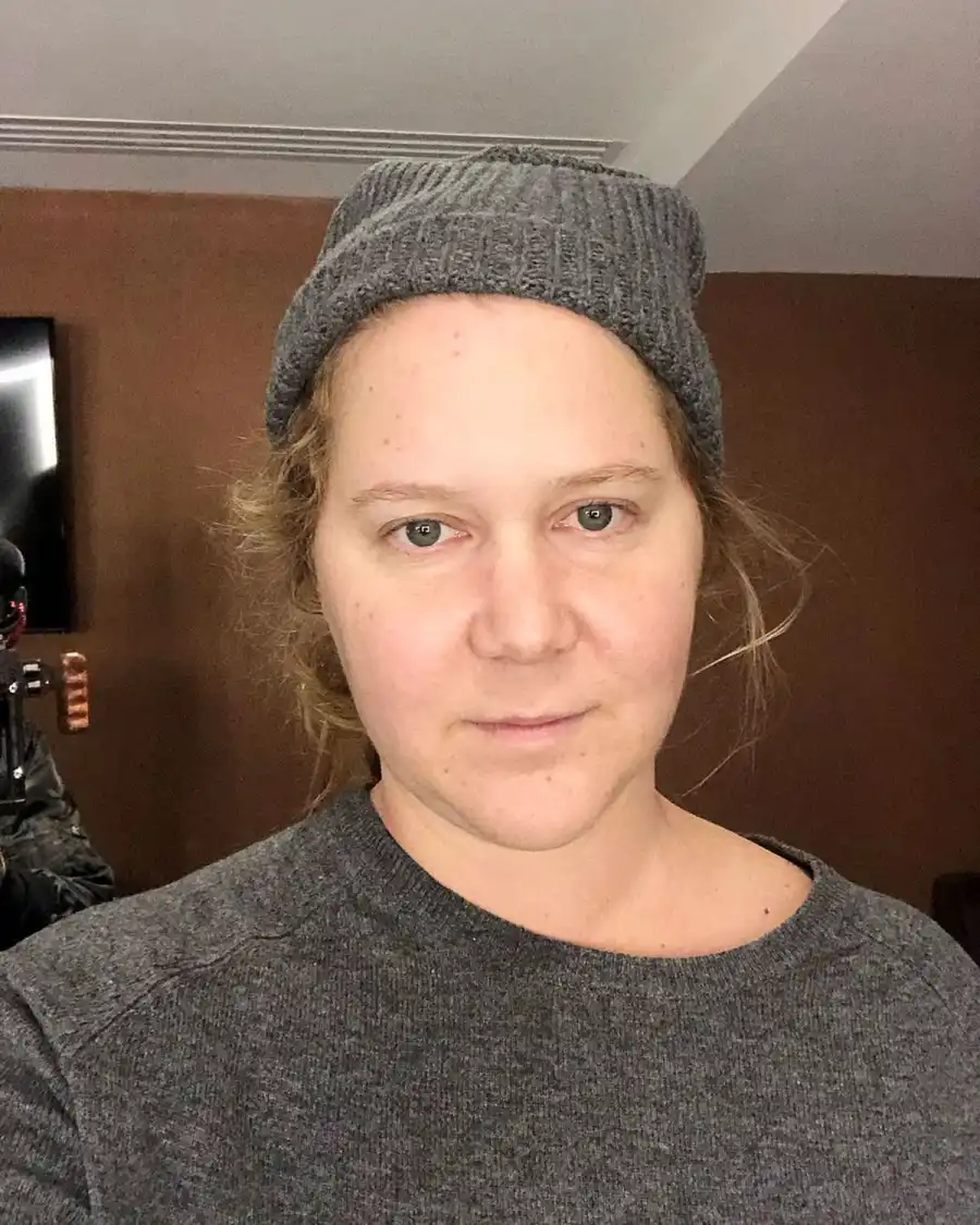 Amy Schumer Gets Real About Experiencing Crushing Anxiety