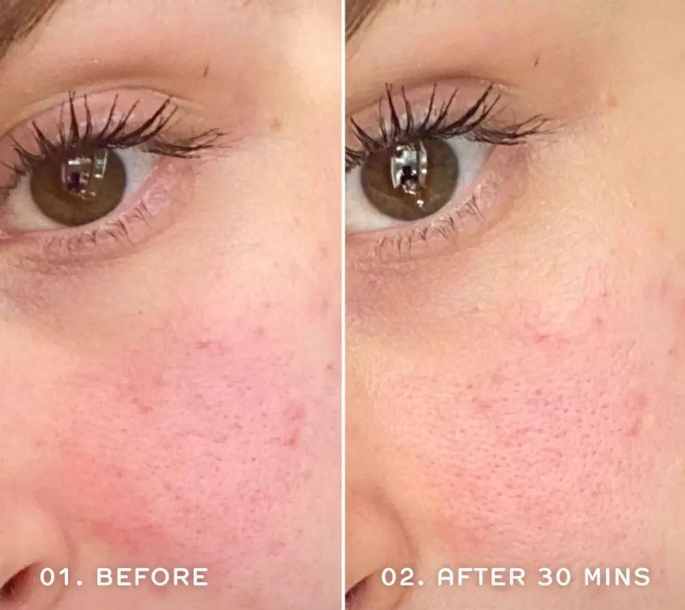 Evercalm&trade; Redness Relief Serum