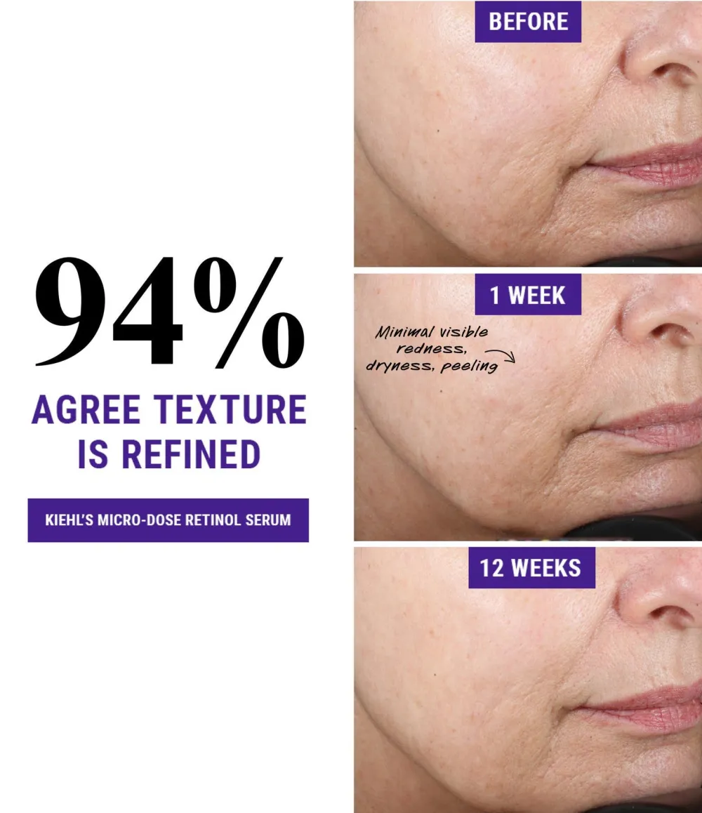 Kiehls Since 1851 Retinol Skin-Renewing Daily Micro-Dose Serum