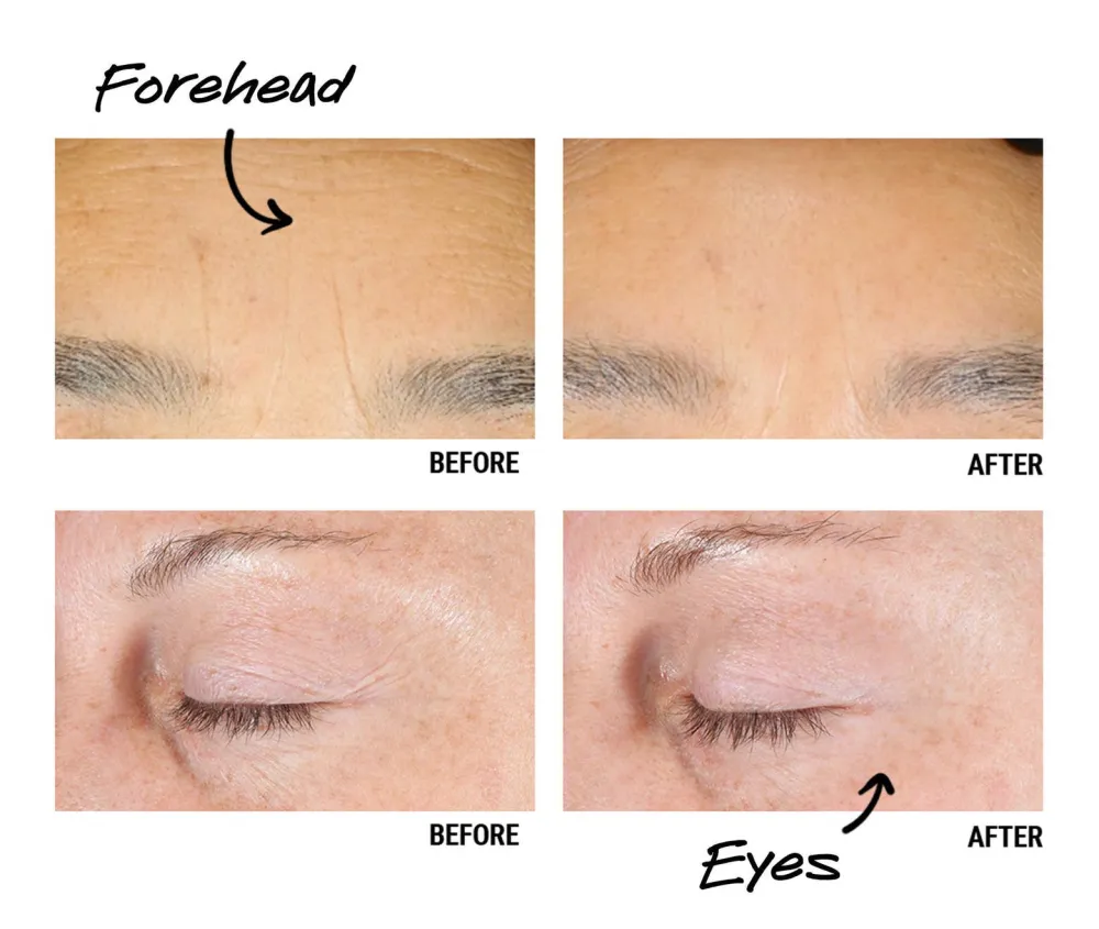 Kiehls Since 1851 Retinol Skin-Renewing Daily Micro-Dose Serum