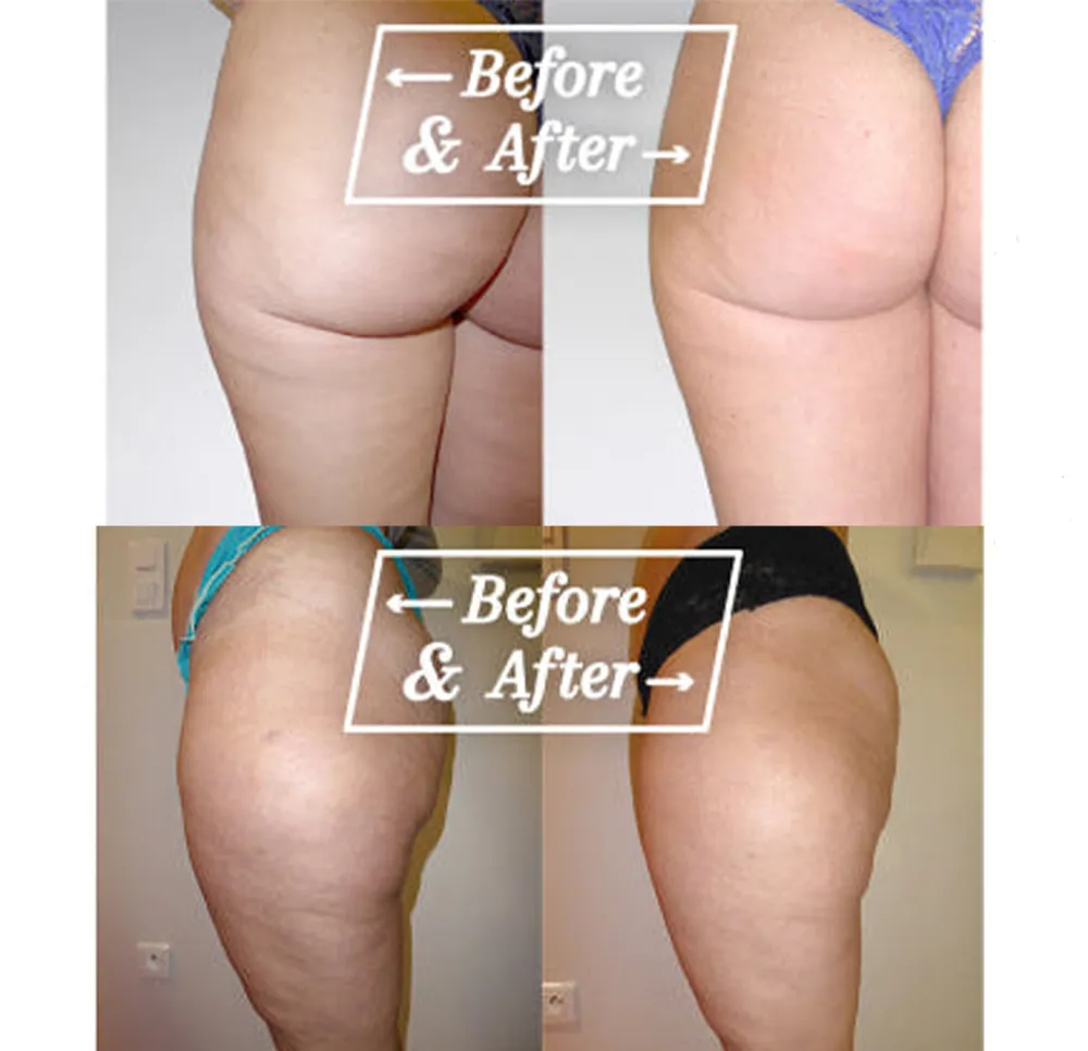 Multi Collagen Burn Powder - Unflavored