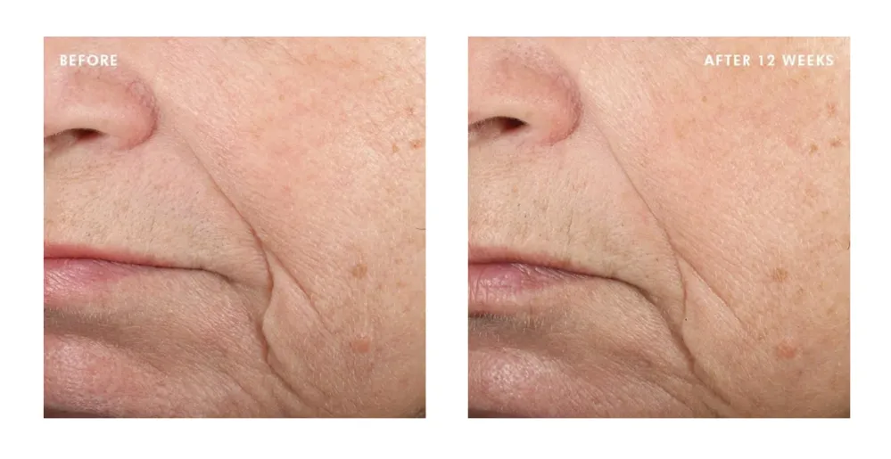 Triple Lipid Restore 2:4:2 Anti-Aging Cream