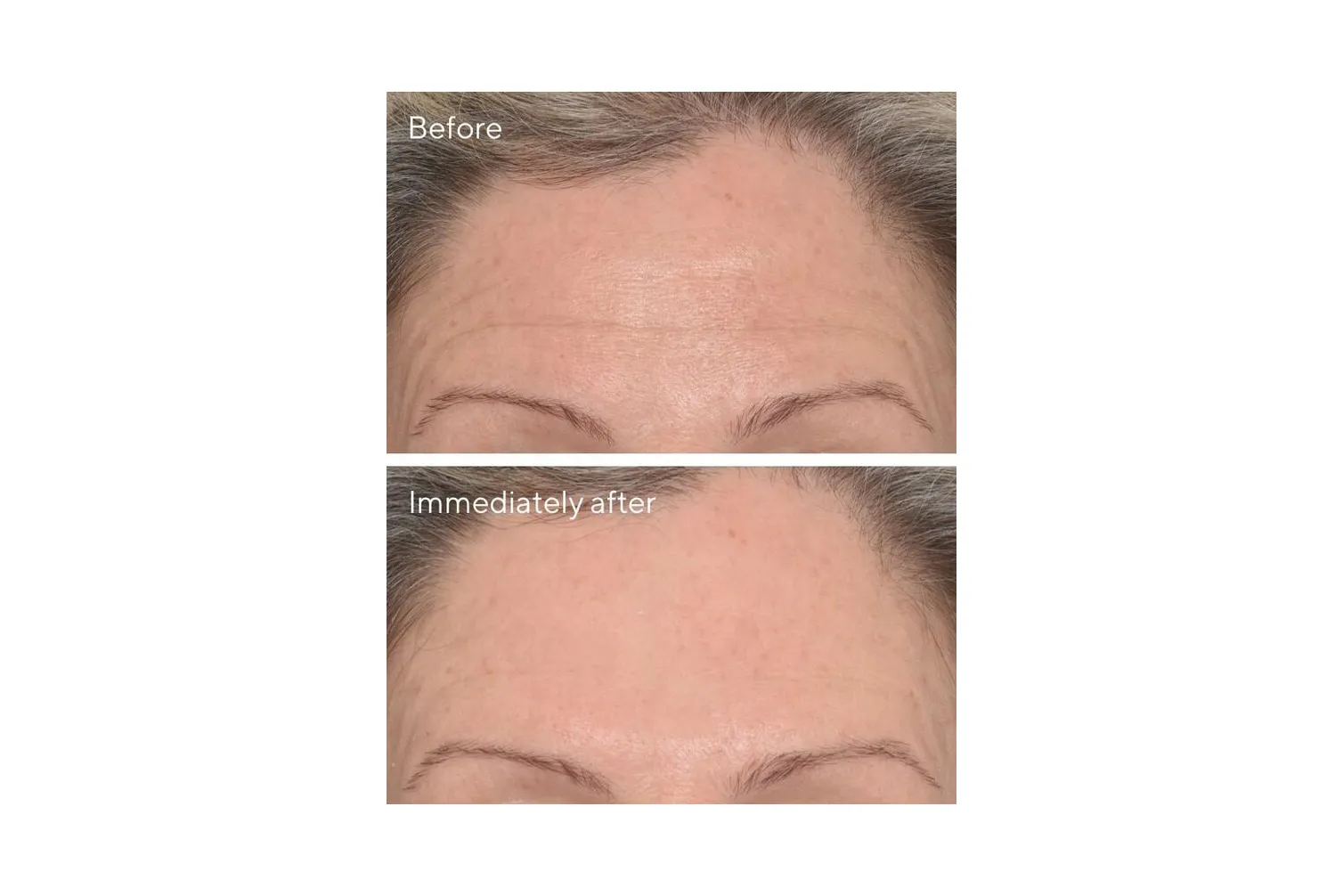 Murad wrinkle corrector