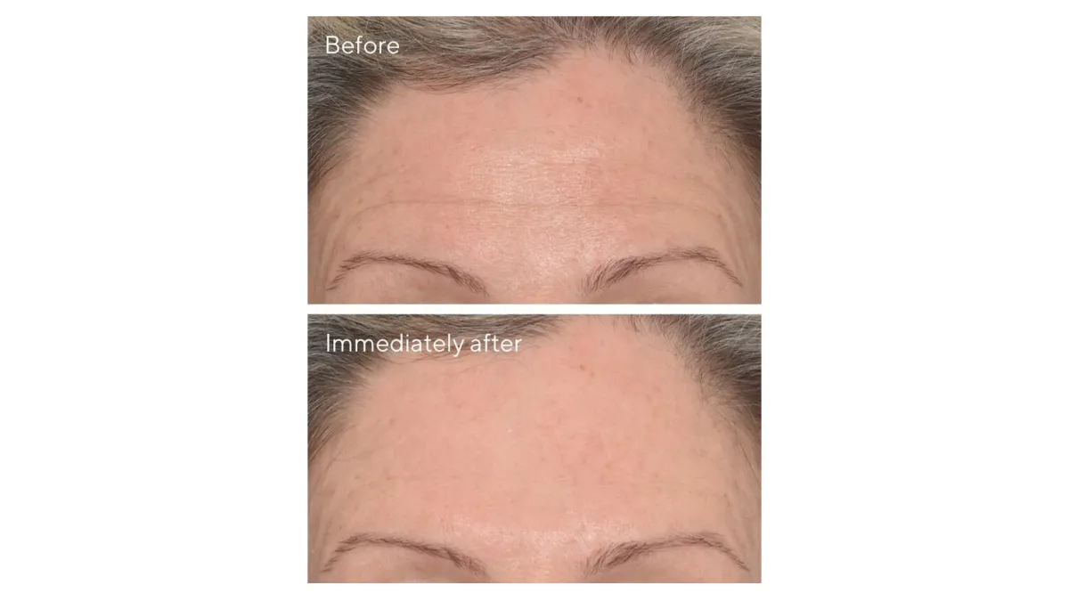 Murad wrinkle corrector