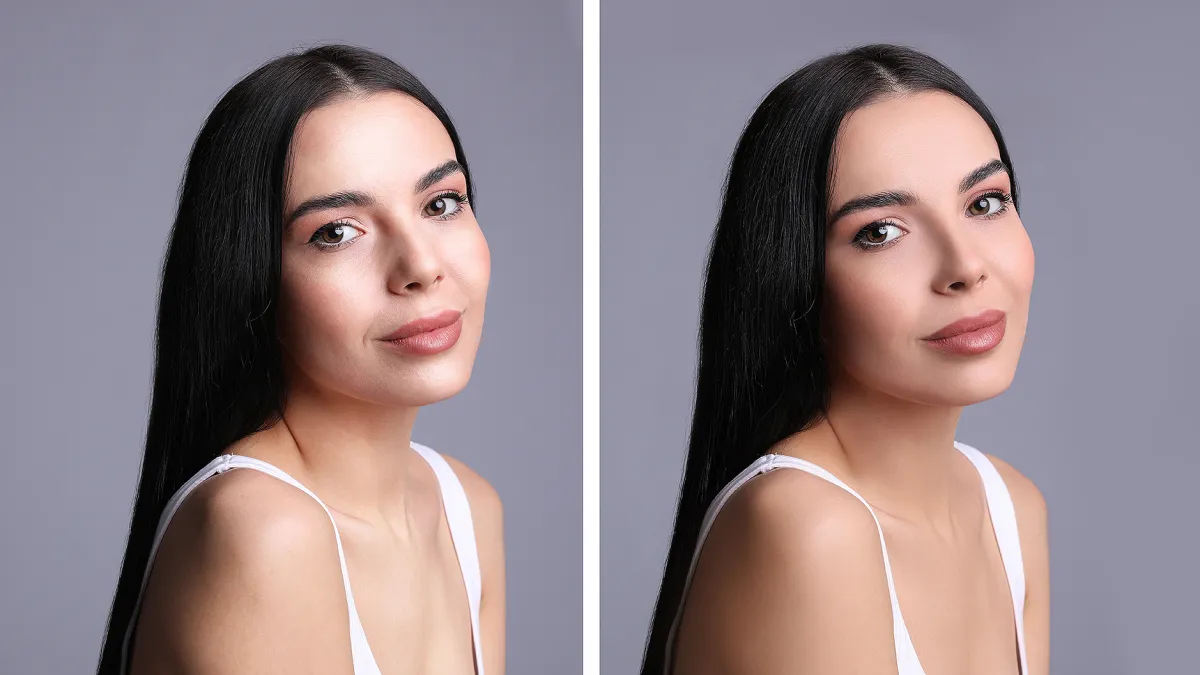 oily-skin-before-after